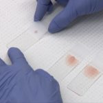 Blood smears