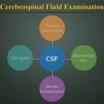 CSF analysis