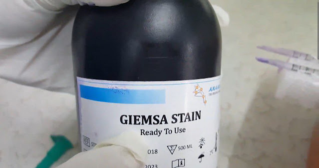 Giemsa stain