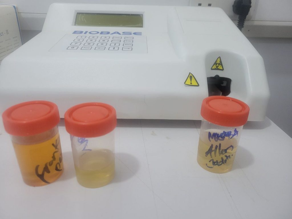 Urine specimens