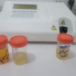 Urine specimens