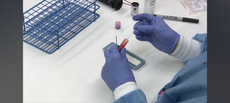 haematocrit using microhematocrit